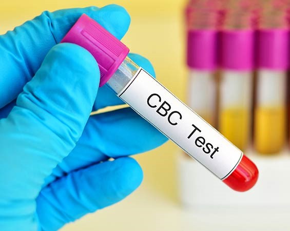 Complete Blood Count (CBC): Normal Ranges & Test Details